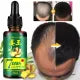7 Days Hair Growth Germinal Serum Oil Natural Hair Treatment Effective Fast Growth Hair Care 30ML